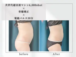 小顔矯正専門店 【RED】池田のエステ・リラクイメージ