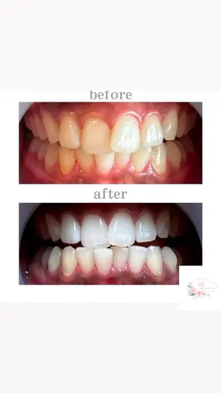 ホワイトニングショップ本厚木所属・ホワイトニング ショップ本厚木のその他イメージ