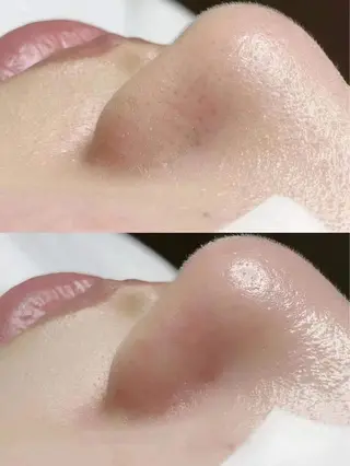 所沢痩身小顔コルギ AromaQueenのエステ・リラクイメージ