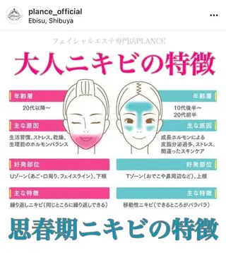 フェイシャル専門 肌質改善/プランスのエステ・リラクイメージ