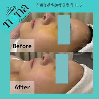 小顔痩身インディバ Nana表参道のエステ・リラクイメージ