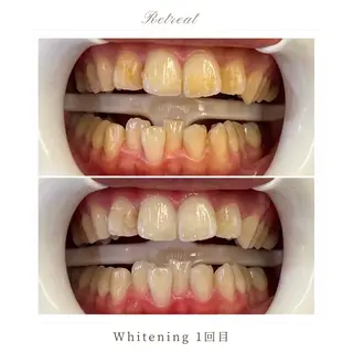 Retreatリトリート所属・歯科医院提携 Retreatのその他イメージ