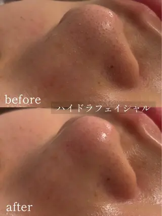 saronM所属・saron Mのエステ・リラクイメージ