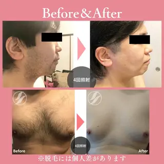 メンズ キッズ 有人型セルフサロン 脱毛/痩身/美顔のその他イメージ