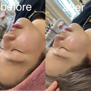 美容鍼灸サロン mahoroba院長のエステ・リラクイメージ