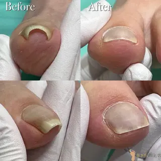 ネイル 東京巻き爪アカデミー所属・東京巻き爪 アカデミーのエステ・リラクイメージ