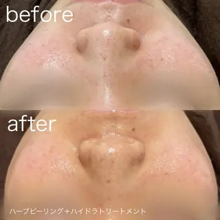 lulularico Yuのエステ・リラクイメージ