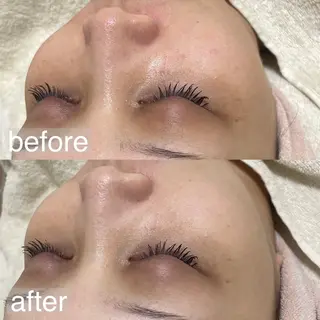 アイブロウ&フェイシャルサロンa‘lm所属・WAX脱毛/肌質改善 眉毛とお肌のサロンのエステ・リラクイメージ
