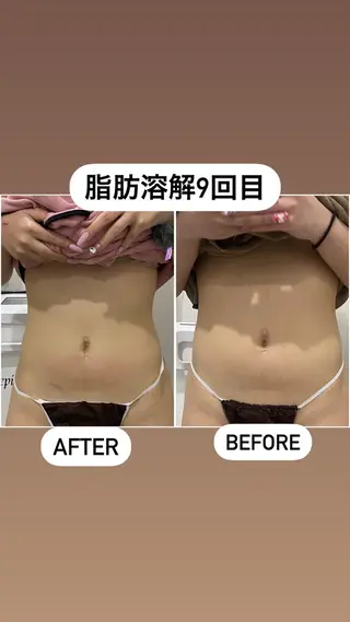 毛穴洗浄・痩身・脱毛 /アルカンジュのエステ・リラクイメージ