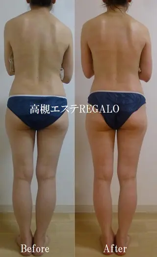 REGALO所属・矢野 さやかのエステ・リラクイメージ