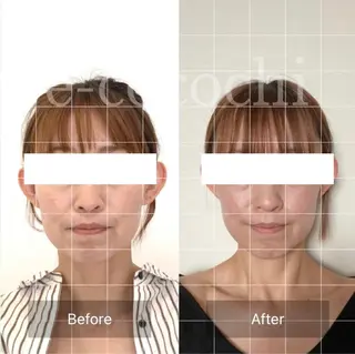 小顔と ヘッドスパのお店のエステ・リラクイメージ