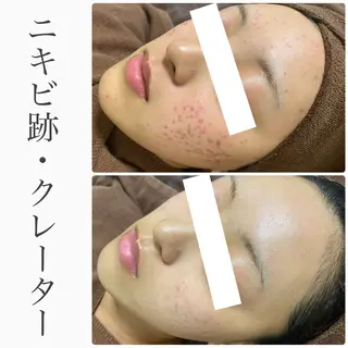 ハーブピーリング専門 BIOEL横浜のエステ・リラクイメージ