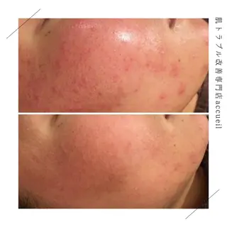 セミロング カラー パーマ ヘアアレンジ メンズ キッズ ネイル マツエク・マツパ アイブロウ 触れたくなる モテ肌へ...❤︎のエステ・リラクイメージ