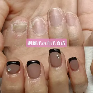 ネイル 深爪矯正/爪育成ケア manie nailのネイルデザイン