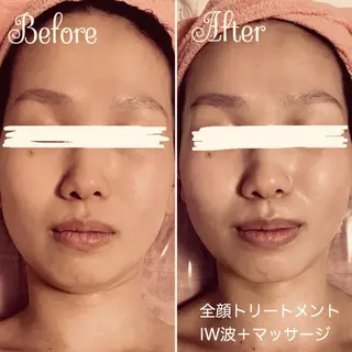 透明感の肌Lino malieのエステ・リラクイメージ