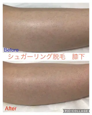 子宮矯正/腸揉み/ シュガーリング脱毛のエステ・リラクイメージ