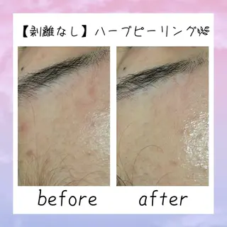 肌質改善Charme coco  みさのエステ・リラクイメージ