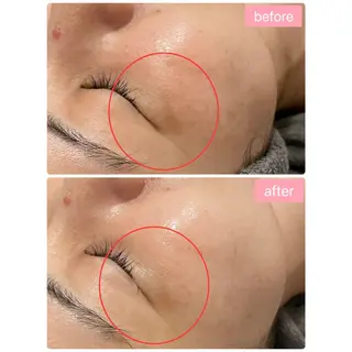 Monart -deux-のエステ・リラクイメージ