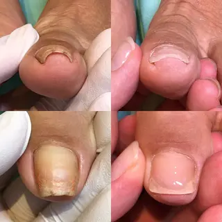 ネイル 東京巻き爪アカデミー所属・東京巻き爪 アカデミーのエステ・リラクイメージ