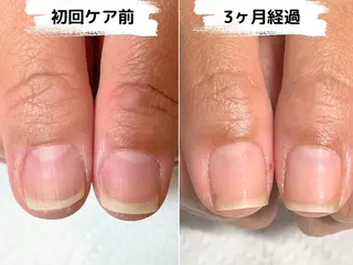 ネイル Ka pilina所属・自爪育成専門店 Kapilinaのネイルデザイン
