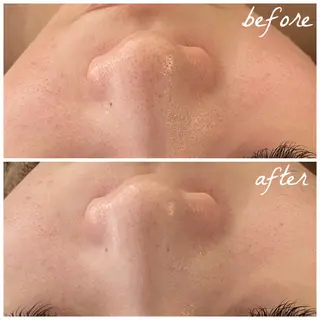 メンズ メナード岐阜茜部 杉浦のエステ・リラクイメージ