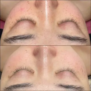 LiZA エステティックサロンのエステ・リラクイメージ