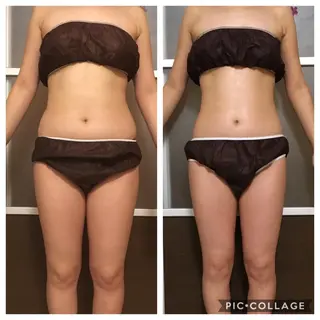 セミロング カラー パーマ メンズ ネイル マツエク・マツパ アニメ,Vオタク× 即効痩せエステサロンのエステ・リラクイメージ