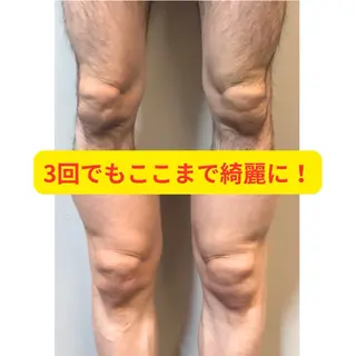 メンズ 毛穴洗浄特化🫧 オオツカのエステ・リラクイメージ