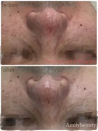 Amilybeauty所属・Amily beauty 毛利のその他イメージ