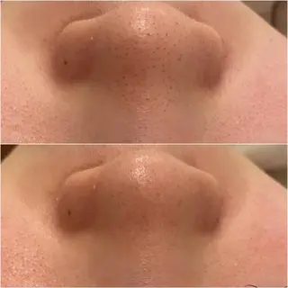 ✨美肌水光✨ アトリエリュバンのエステ・リラクイメージ