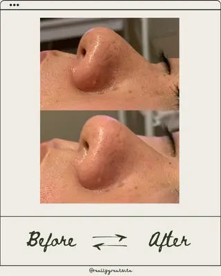 Linné  Yomogi Spa所属・Linné Amiのエステ・リラクイメージ