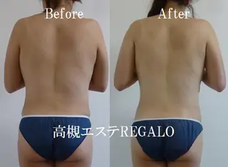 REGALO所属・矢野 さやかのエステ・リラクイメージ