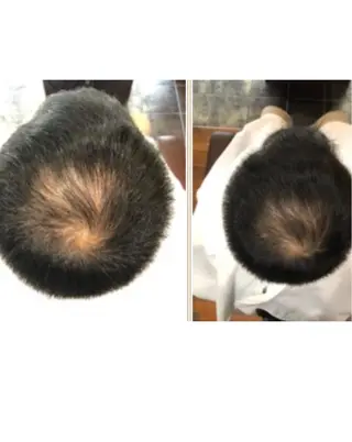 40代からの髪悩み 専門美髪アドバイザーのヘアスタイル
