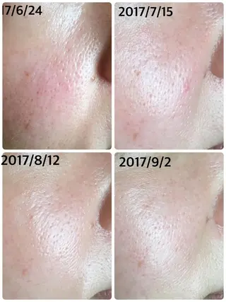 メナードフェイシャルサロン西区天塚所属・平岩 仁美のエステ・リラクイメージ