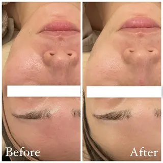 ✨美肌水光✨ アトリエリュバンのエステ・リラクイメージ