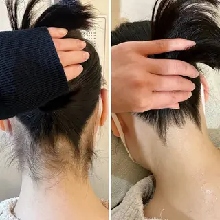 うなじ脱毛/美肌脱毛 LABELのエステ・リラクイメージ