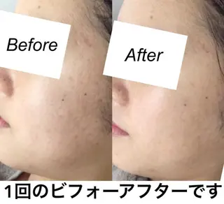 ミディアム カラー パーマ ヘアアレンジ キッズ ネイル マツエク・マツパ 都度払い肌質改善 &脱毛Blancheのエステ・リラクイメージ