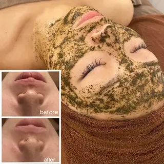 美白🎀毛穴洗浄🫧 ハーブピーリング🌿のエステ・リラクイメージ
