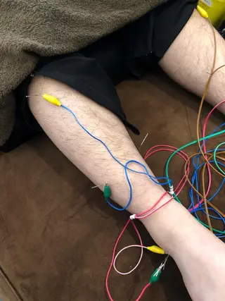 美容鍼灸整体サロンBeauJu所属・小顔矯/美容鍼/鍼灸 BeauJuのその他イメージ