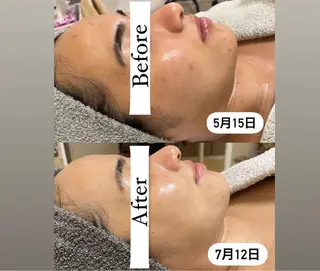 美肌専門サロン M 💎のエステ・リラクイメージ