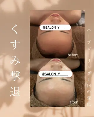 コルギ✖︎ピーリング y ANESISのエステ・リラクイメージ
