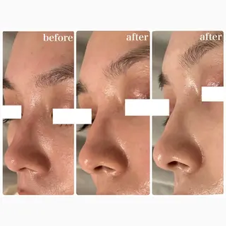 Lily branc 痩身/小顔/肌質改善のエステ・リラクイメージ