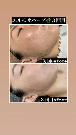 Natsu *メンズネイリストのネイルデザイン