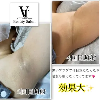 メンズ ATTO SHIORIのエステ・リラクイメージ