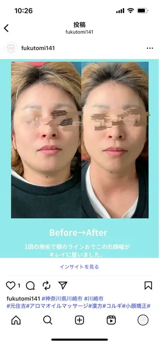 指圧処福ちゃん所属・福 ちゃんのエステ・リラクイメージ