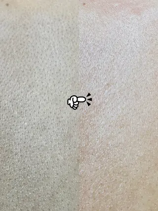 Hit. シュガーリング豊橋のエステ・リラクイメージ