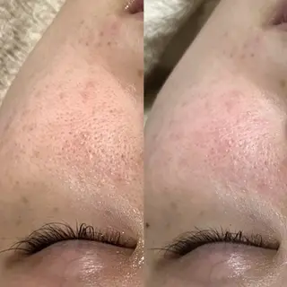 アイブロウ&フェイシャルサロンa‘lm所属・WAX脱毛/肌質改善 眉毛とお肌のサロンのエステ・リラクイメージ