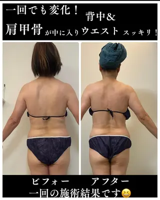 痩身&ボディメンテナンス専門サロン　Shikhara（シカラ）所属・オールハンド筋膜痩身 整体/小顔　中山朝美のエステ・リラクイメージ