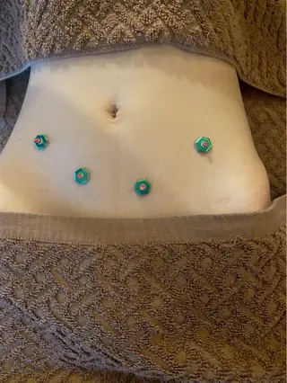 Acupuncture  salon LINOA リノア鍼灸院所属・LINOAヘッドスパ 小顔ケア/逆子ケアのエステ・リラクイメージ