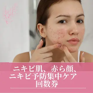 ニキビ、痩身、脱毛、 サクラチャンスパのエステ・リラクイメージ